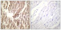 Troponin I-C (phospho Ser43) Polyclonal Antibody