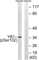 YB-1 (phospho Ser102) Polyclonal Antibody