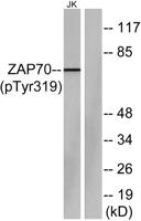 ZAP-70 (phospho Tyr319) Polyclonal Antibody