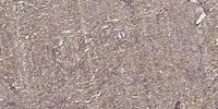 ZAP-70 (phospho Tyr319) Polyclonal Antibody