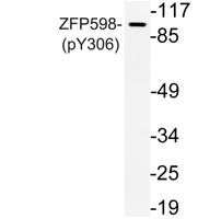 ZFP598 (phospho Tyr306) Polyclonal Antibody