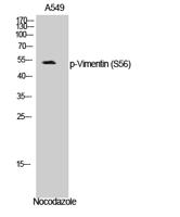 Vimentin (phospho Ser56) Polyclonal Antibody