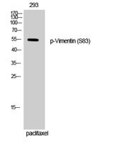 Vimentin (phospho Ser83) Polyclonal Antibody