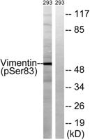 Vimentin (phospho Ser83) Polyclonal Antibody