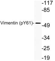 Vimentin (phospho Tyr61) Polyclonal Antibody