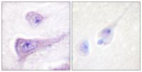 WASP (phospho Tyr290) Polyclonal Antibody