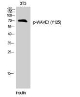 WAVE1 (phospho Tyr125) Polyclonal Antibody