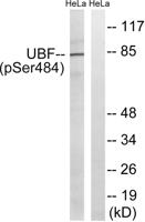 UBF (phospho Ser484) Polyclonal Antibody