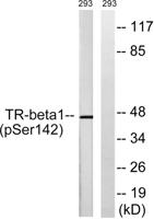 TRβ1 (phospho Ser142) Polyclonal Antibody