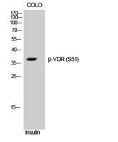 VDR (phospho Ser51) Polyclonal Antibody