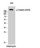 Tuberin (phospho Ser939) Polyclonal Antibody