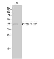 TOB1 (phospho Ser164) Polyclonal Antibody