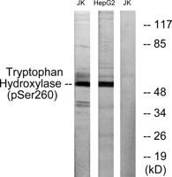 TPH1 (phospho Ser260) Polyclonal Antibody