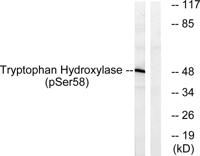 TPH1 (phospho Ser58) Polyclonal Antibody