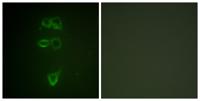 Tie-2 (phospho Tyr1108) Polyclonal Antibody