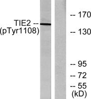 Tie-2 (phospho Tyr1108) Polyclonal Antibody