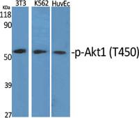 Akt1 (phospho Thr450) Polyclonal Antibody