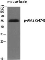 Akt2 (phospho Ser474) Polyclonal Antibody