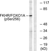 FoxO1 (phospho Ser256) Polyclonal Antibody