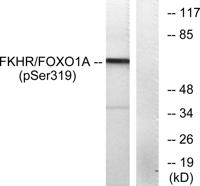 FoxO1 (phospho Ser319) Polyclonal Antibody