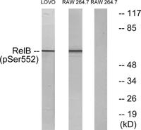 RelB (phospho Ser552) Polyclonal Antibody