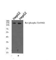 Ret (phospho Tyr1062) Polyclonal Antibody