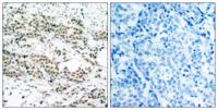 FoxO4 (phospho Ser197) Polyclonal Antibody