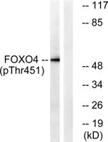 FoxO4 (phospho Thr451) Polyclonal Antibody