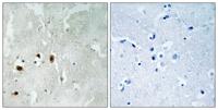 TIP60 (phospho Ser90) Polyclonal Antibody