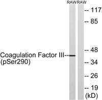 TF (phospho Ser290) Polyclonal Antibody