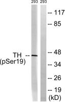 TH (phospho Ser19) Polyclonal Antibody