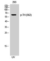 TH (phospho Ser62) Polyclonal Antibody