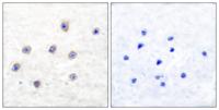 TH (phospho Ser62) Polyclonal Antibody