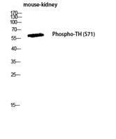 TH (phospho Ser71) Polyclonal Antibody