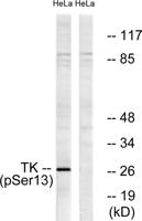 Thymidine Kinase (phospho Ser13) Polyclonal Antibody