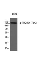 TBC1D4 (phospho Thr642) Polyclonal Antibody