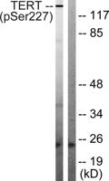 TERT (phospho Ser227) Polyclonal Antibody