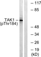 Tak1 (phospho Thr184) Polyclonal Antibody