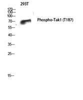 Tak1 (phospho Thr187) Polyclonal Antibody