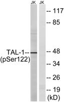 TAL1 (phospho Ser122) Polyclonal Antibody