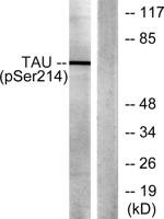 Tau (phospho Ser214) Polyclonal Antibody