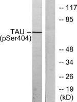 Tau (phospho Ser404) Polyclonal Antibody