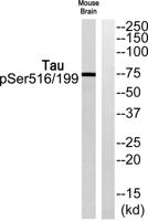 Tau (phospho Ser516/199) Polyclonal Antibody