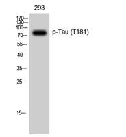 Tau (phospho Thr181) Polyclonal Antibody