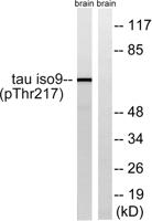 Tau (phospho Thr534) Polyclonal Antibody