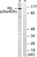 Rb (phospho Ser608) Polyclonal Antibody