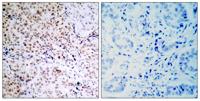 Rb (phospho Ser795) Polyclonal Antibody