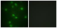 Rb (phospho Ser811) Polyclonal Antibody