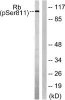 Rb (phospho Ser811) Polyclonal Antibody