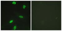 Rb (phospho Thr821) Polyclonal Antibody